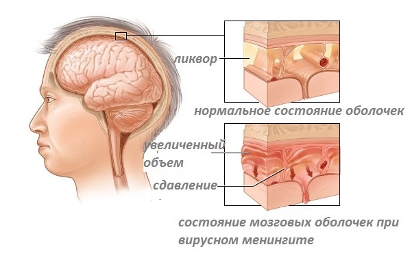 можно при беременности пользоваться кремом для депиляции можно при беременности пользоваться кремом для депиляции